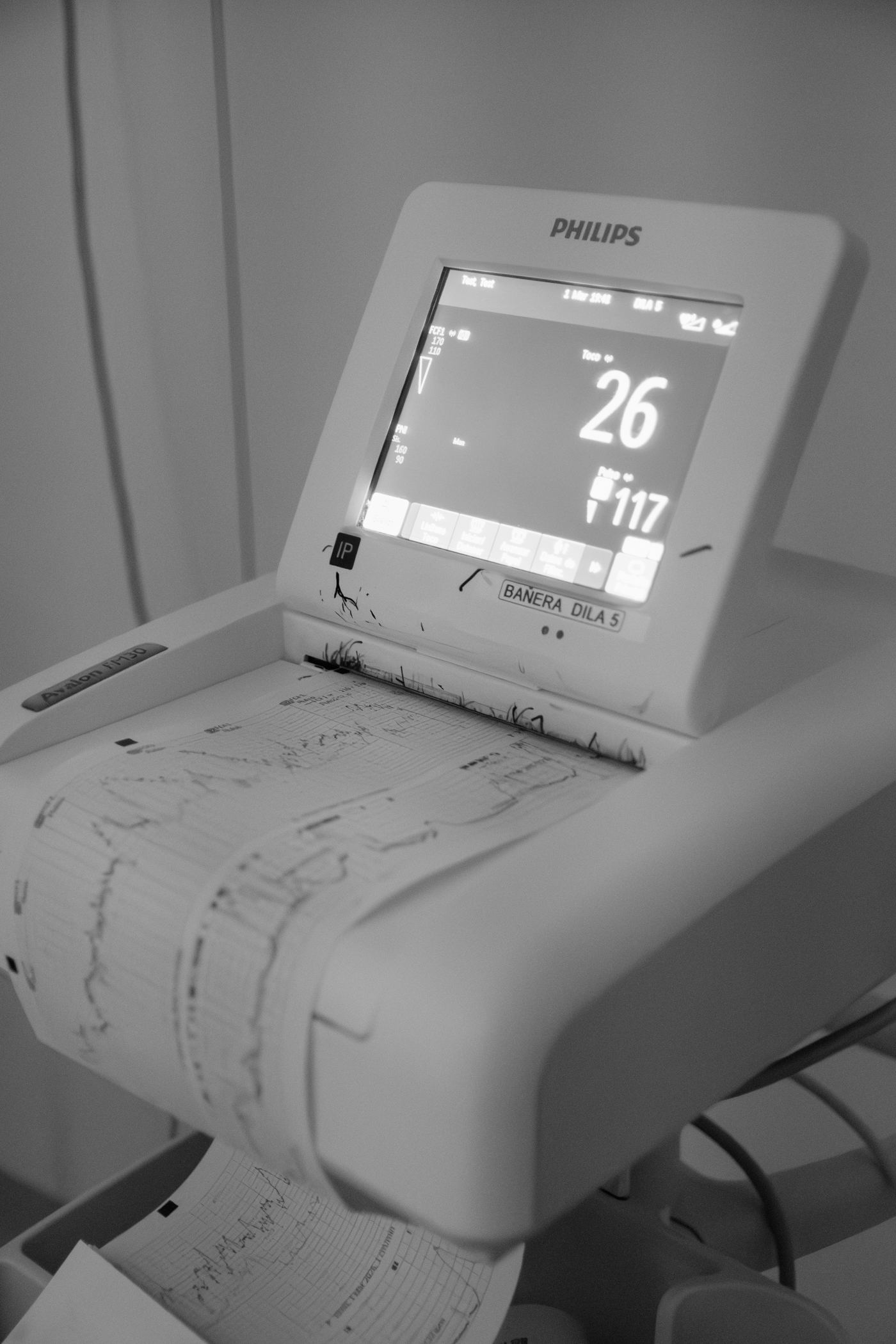 Monitor de constantes registrando la frecuencia cardíaca fetal y las contracciones durante un parto